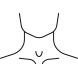 갑상샘 항진증